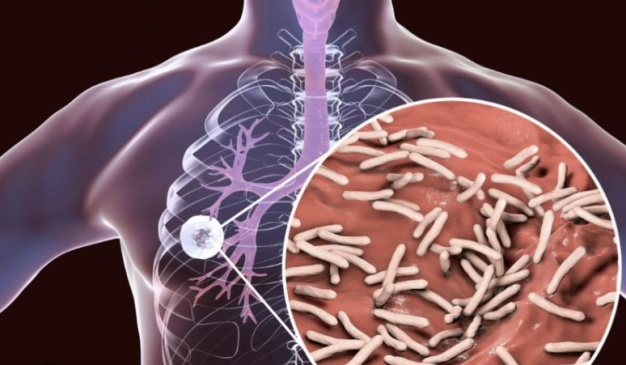 Ilustrasi medis 3D anatomi paru-paru dan perbesaran bakteri Mycobacterium tuberculosis berbentuk batang penyebab penyakit TBC